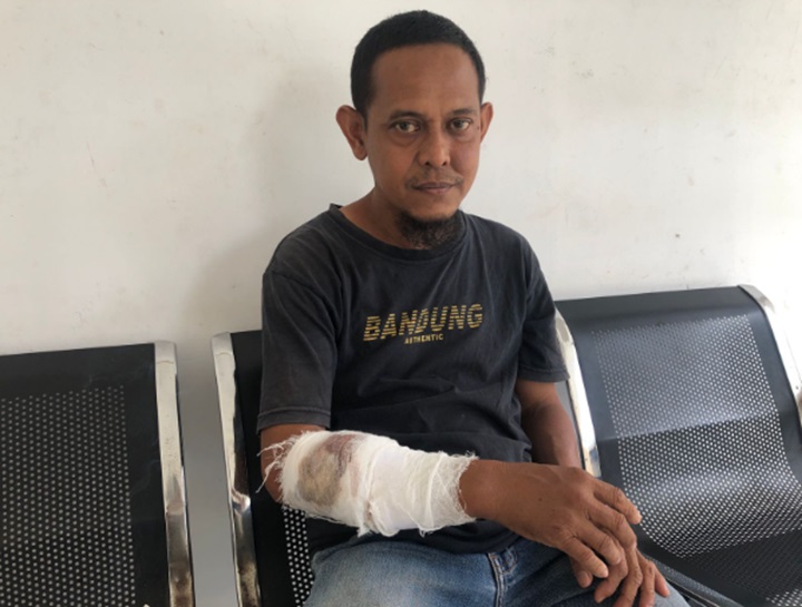 kudratullah korban serangan monyet